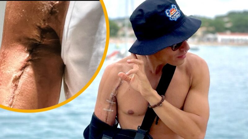 Marc Marquez arm injury